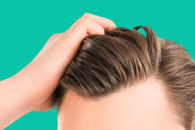 Caída del cabello: Beneficios del cannabis y el aceite de cáñamo